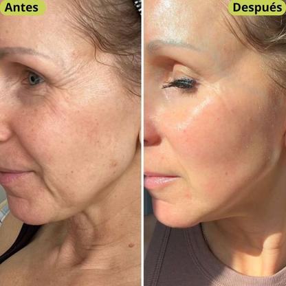 Celimax Retinal Shot® - Elimina Arrugas e Ilumina tu Rostro